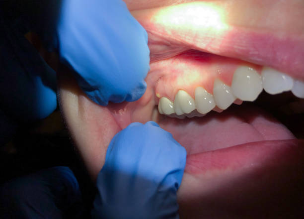 Best Weekend Emergency Dentist in Wheaton, MN