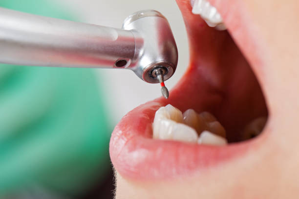 Best Pediatric Emergency Dentist in Wheaton, MN
